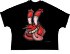 Krabs